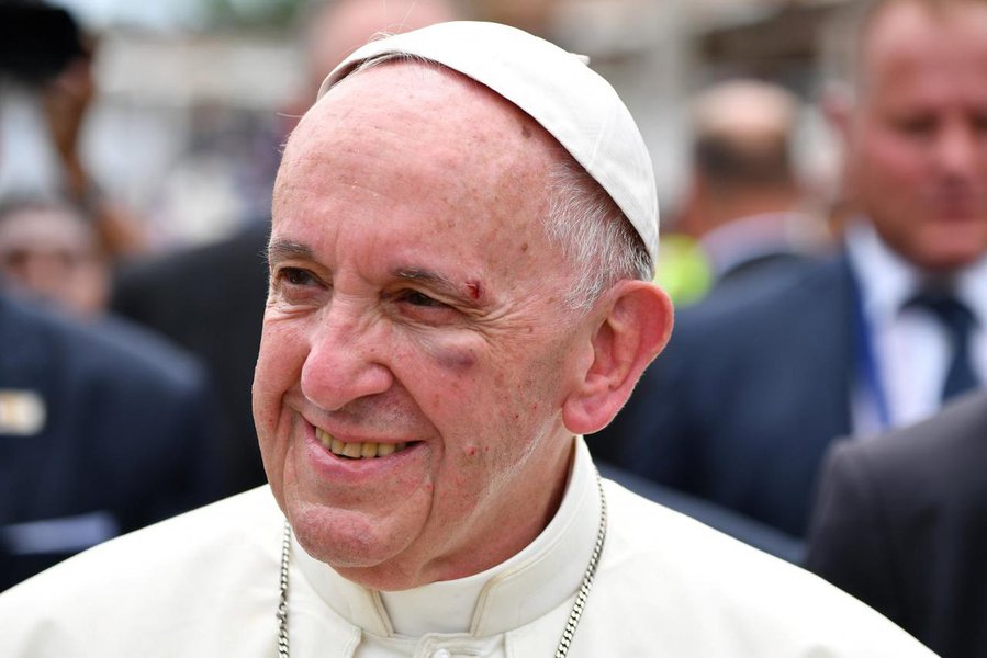 Papa Francisco machuca o rosto na última etapa de viagem à Colômbia (Foto: Sebastião Costa) Papa Francisco machuca o rosto na última etapa de viagem à Colômbia