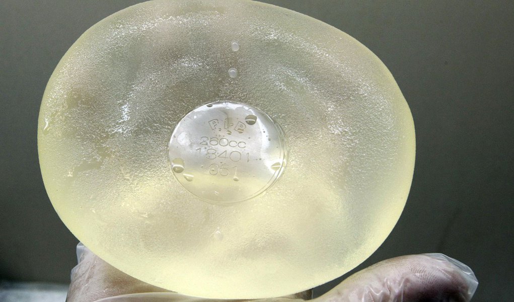 SUS vai bancar troca de próteses rompidas das marcas PIP e Rofil (Foto: ERIC GAILLARD/REUTERS) SUS vai bancar troca de próteses rompidas das marcas PIP e Rofil