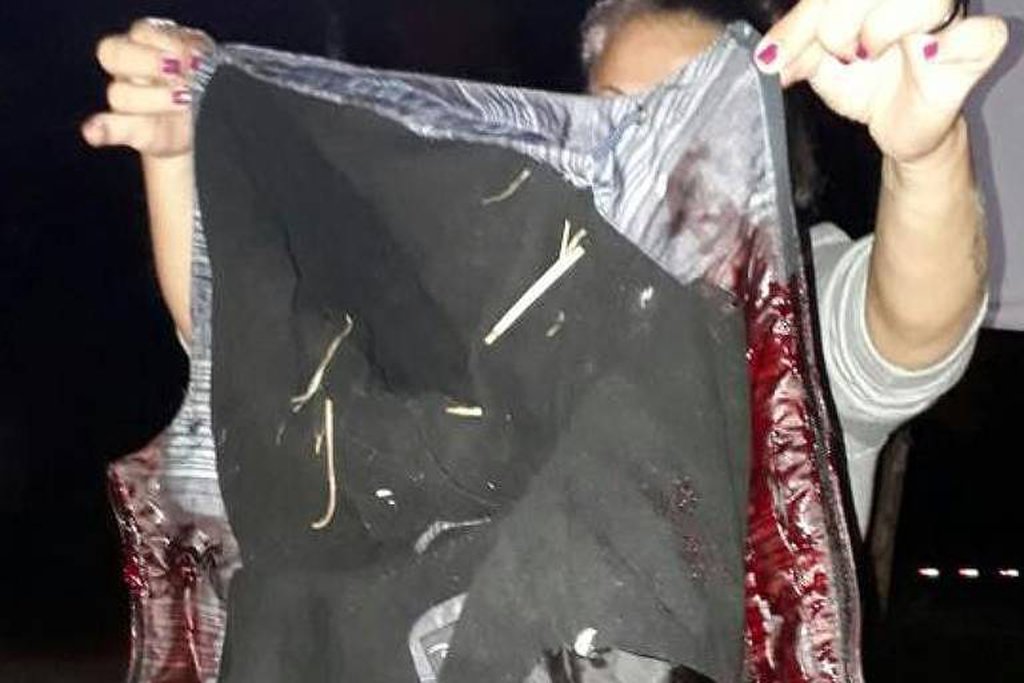 Ontem, atentado à caravana de Lula, com tiros em um dos ônibus. Hoje, mais tiros, de madrugada, em pessoas absolutamente indefesas. Um ataque covarde e inaceitável (Foto: Reginaldo Lopes) Ontem, atentado à caravana de Lula, com tiros em um dos ônibus. Hoje, mais tiros, de madrugada, em pessoas absolutamente indefesas. Um ataque covarde e inaceitável