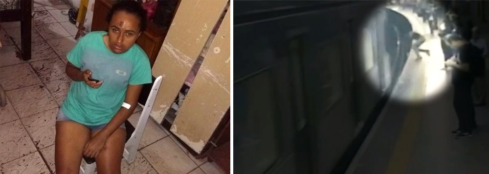 Jussara Araújo de Souza, a mulher empurrada para os trilhos do Metrô de São Paulo disse que sentiu os vagões do trem passarem por sobre seu corpo e que ainda não acredita como saiu viva do incidente; ela estava indo da estação Conceição para a estação Marechal Deodoro, na região central de São Paulo, para trabalhar e por conta do queda nos trilhos, ela levou 30 pontos na perna, tem hematomas na testa e nos braços (Foto: Charles Nisz) Jussara Araújo de Souza, a mulher empurrada para os trilhos do Metrô de São Paulo disse que sentiu os vagões do trem passarem por sobre seu corpo e que ainda não acredita como saiu viva do incidente; ela estava indo da estação Conceição para a estação Marechal Deodoro, na região central de São Paulo, para trabalhar e por conta do queda nos trilhos, ela levou 30 pontos na perna, tem hematomas na testa e nos braços