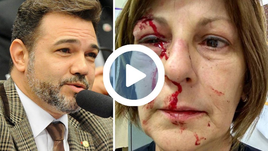 Deputado e pastor Marcos Feliciano (PSC-SP) manifesta "repúdio" à agressão e diz que "nada justifica" o ato, mas logo depois diz ter descoberto, nas redes sociais da professora, que ela é "militante de esquerda" e "destila ódio" na internet contra parlamentares; "Quem planta o ódio colhe o ódio. A senhora doutrina os seus alunos e agora o feitiço vira contra o feiticeiro", diz (Foto: Gisele Federicce) Deputado e pastor Marcos Feliciano (PSC-SP) manifesta "repúdio" à agressão e diz que "nada justifica" o ato, mas logo depois diz ter descoberto, nas redes sociais da professora, que ela é "militante de esquerda" e "destila ódio" na internet contra parlamentares; "Quem planta o ódio colhe o ódio. A senhora doutrina os seus alunos e agora o feitiço vira contra o feiticeiro", diz