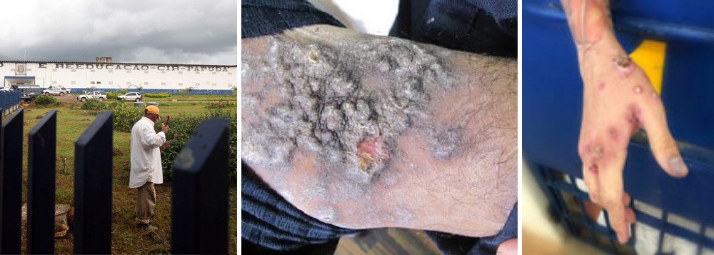 A Secretaria de Segurança Pública do Distrito Federal (SSP-DF) informou que o número de presidiários contaminados por doenças infecciosas no Complexo Penitenciário da Papuda, no Distrito Federal, aumentou 202,7% em uma semana, ao passar de 692 para 2.095 em uma semana; a contaminação atinge cinco dos seis prédio do complexo; o Ministério Público (MPDFT) enviou recomendação à SSP-DF para que medidas de combate às doenças sejam cumpridas com rigor (Foto: Leonardo Lucena) A Secretaria de Segurança Pública do Distrito Federal (SSP-DF) informou que o número de presidiários contaminados por doenças infecciosas no Complexo Penitenciário da Papuda, no Distrito Federal, aumentou 202,7% em uma semana, ao passar de 692 para 2.095 em uma semana; a contaminação atinge cinco dos seis prédio do complexo; o Ministério Público (MPDFT) enviou recomendação à SSP-DF para que medidas de combate às doenças sejam cumpridas com rigor