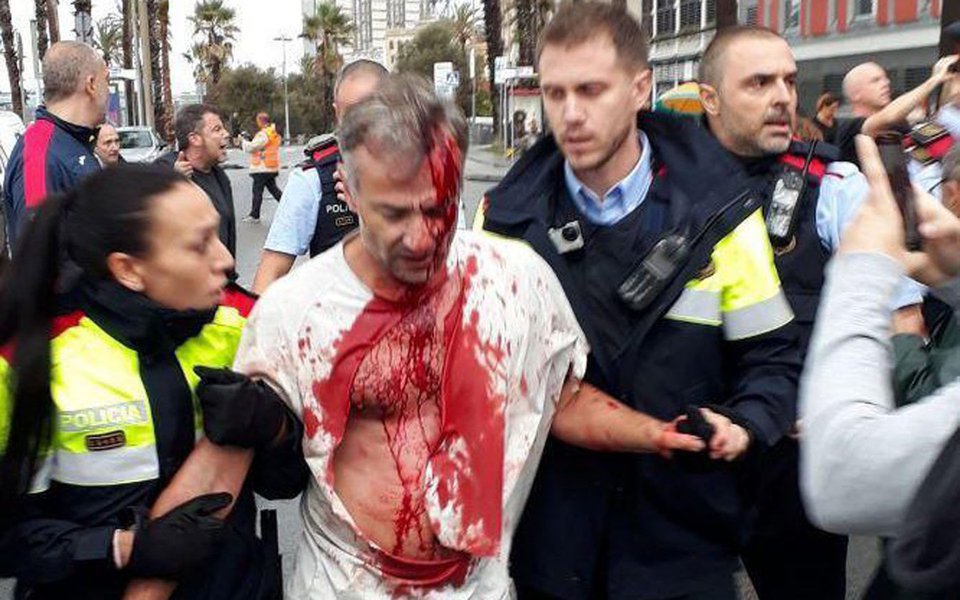 Serviços de saúde da Catalunha prestaram atendimento médico a 893 pessoas - quatro em estado grave - como resultado de ferimentos sofridos durante confrontos com a polícia no domingo (1); polícia espanhola usou cacetetes e balas de borracha para frustrar uma votação sobre a independência na Catalunha (Foto: Paulo Emílio) Serviços de saúde da Catalunha prestaram atendimento médico a 893 pessoas - quatro em estado grave - como resultado de ferimentos sofridos durante confrontos com a polícia no domingo (1); polícia espanhola usou cacetetes e balas de borracha para frustrar uma votação sobre a independência na Catalunha