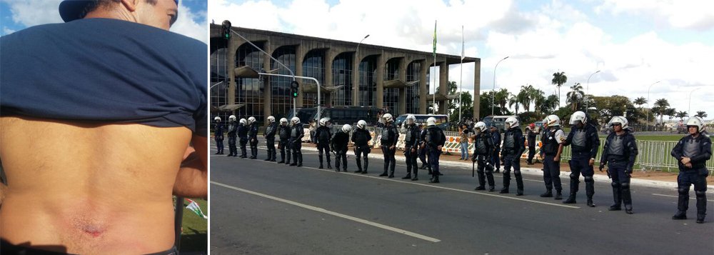 O presidente do Sindicato dos Policiais Civis na Bahia, Marcos Maurício, tomou um tiro de bala de borracha da Polícia Militar no protesto contra Michel Temer nesta quarta-feira em Brasília; apesar da agressão, o policial afirmou que a categoria vai intensificar as manifestações contra as reformas propostas pelo governo, e relatou as cenas de guerra que assistiu; "Hoje vivemos uma cena de guerra. A PM avançou nas áreas destinadas aos manifestantes e agrediu mulheres, crianças, estudantes e policiais civis com bomba de gás lacrimogêneo e balas de borracha. Um verdadeiro atentado ao Estado Democrático e de Direito", disse Marcos Maurício (Foto: Romulo Faro) O presidente do Sindicato dos Policiais Civis na Bahia, Marcos Maurício, tomou um tiro de bala de borracha da Polícia Militar no protesto contra Michel Temer nesta quarta-feira em Brasília; apesar da agressão, o policial afirmou que a categoria vai intensificar as manifestações contra as reformas propostas pelo governo, e relatou as cenas de guerra que assistiu; "Hoje vivemos uma cena de guerra. A PM avançou nas áreas destinadas aos manifestantes e agrediu mulheres, crianças, estudantes e policiais civis com bomba de gás lacrimogêneo e balas de borracha. Um verdadeiro atentado ao Estado Democrático e de Direito", disse Marcos Maurício