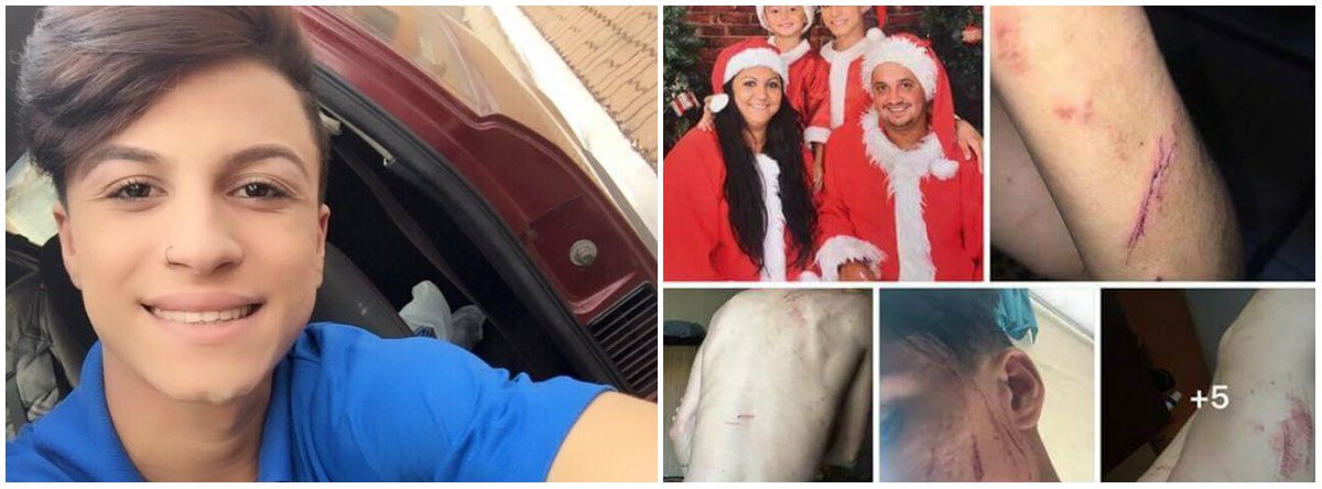Um dia antes de desaparecer, o jovem Itaberli Lozano, de 17 anos, foi vítima de espancamento que o deixou com hematomas em várias partes do corpo; no dia seguinte à surra, ele postou no Facebook um texto acusando a mãe de ser a mandante das agressões; "No momento estou em Franca, onde ficarei, pois ela deu ordem a todos os meninos para que quando me verem me bater", postou ele; em depoimento, a mãe revelou que matou o filho com três facadas no pescoço (Foto: Gisele Federicce) Um dia antes de desaparecer, o jovem Itaberli Lozano, de 17 anos, foi vítima de espancamento que o deixou com hematomas em várias partes do corpo; no dia seguinte à surra, ele postou no Facebook um texto acusando a mãe de ser a mandante das agressões; "No momento estou em Franca, onde ficarei, pois ela deu ordem a todos os meninos para que quando me verem me bater", postou ele; em depoimento, a mãe revelou que matou o filho com três facadas no pescoço