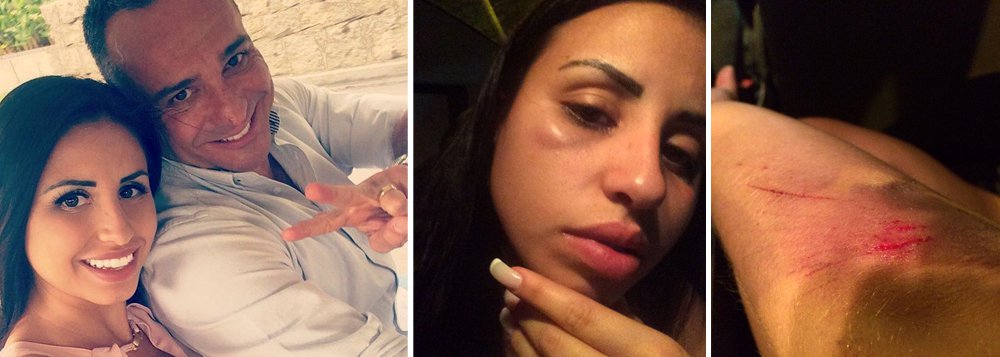 Atriz e modelo Jéssica França Ferreira, de 24 anos, foi agredida, e acusa dois porteiros do prédio onde ela morava com o ex-marido, o ator Hugo Gross, em Curicica, Zona Oeste do Rio, de serem os autores dos golpes; segundo ela, a agressão ocorreu após uma briga do casal; ela teria ido buscar suas coisas no apartamento do ator, mas teria sido impedida de entrar no local por dois porteiros que estavam de plantão; segundo a vítima, os funcionários do prédio informaram que foi Hugo ediu para bater nela, caso ela insistisse entrar no apartamento; "Estou toda arrebentada, não quero mais isso para a minha vida", acrescentou (Foto: Leonardo Lucena) Atriz e modelo Jéssica França Ferreira, de 24 anos, foi agredida, e acusa dois porteiros do prédio onde ela morava com o ex-marido, o ator Hugo Gross, em Curicica, Zona Oeste do Rio, de serem os autores dos golpes; segundo ela, a agressão ocorreu após uma briga do casal; ela teria ido buscar suas coisas no apartamento do ator, mas teria sido impedida de entrar no local por dois porteiros que estavam de plantão; segundo a vítima, os funcionários do prédio informaram que foi Hugo ediu para bater nela, caso ela insistisse entrar no apartamento; "Estou toda arrebentada, não quero mais isso para a minha vida", acrescentou
