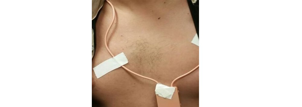 Um candidato que fazia as provas do segundo dia do Enem em Fortaleza foi preso em flagrante por uso de escutas neste domingo; a prisão foi feita por policiais federais em uma universidade do centro da capital cearense; segundo a Polícia Federal, o candidato tinha equipamentos eletrônicos presos ao corpo com pontos de escuta nos ouvidos; em depoimento dado na sede da superintendência do órgão em Fortaleza, o candidato se identificou como secretário da saúde de um município do Ceará; ele poderá responder na Justiça Federal pelos crimes contra fé pública, patrimônio e paz pública (Foto: Romulo Faro) Um candidato que fazia as provas do segundo dia do Enem em Fortaleza foi preso em flagrante por uso de escutas neste domingo; a prisão foi feita por policiais federais em uma universidade do centro da capital cearense; segundo a Polícia Federal, o candidato tinha equipamentos eletrônicos presos ao corpo com pontos de escuta nos ouvidos; em depoimento dado na sede da superintendência do órgão em Fortaleza, o candidato se identificou como secretário da saúde de um município do Ceará; ele poderá responder na Justiça Federal pelos crimes contra fé pública, patrimônio e paz pública