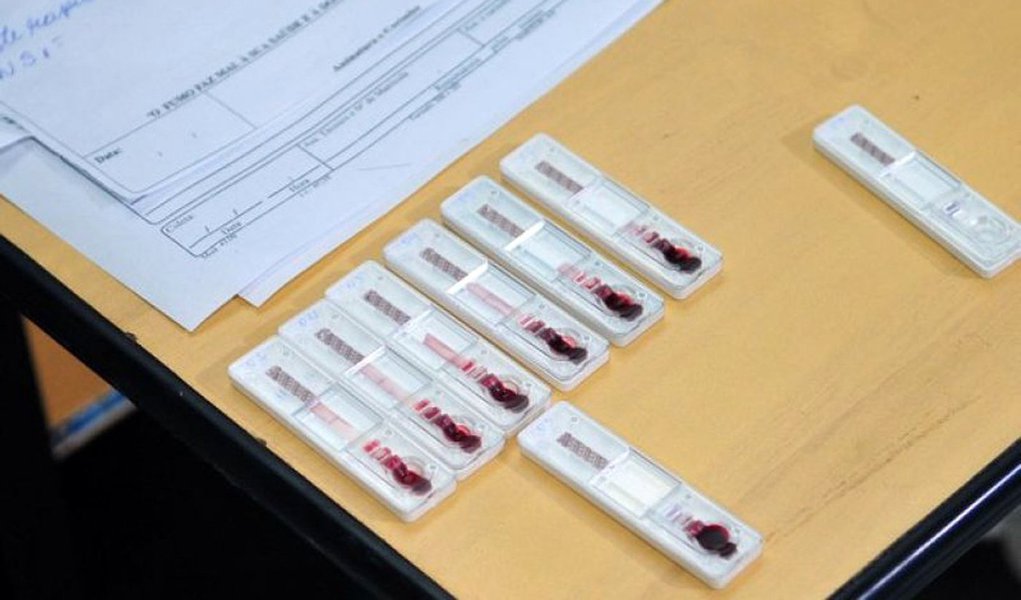 A Secretaria de Saúde confirmou 16.926 moradores de Brasília com dengue — doença transmitida pelo Aedes aegypti — desde janeiro; os dados constam do Informativo Epidemiológico nº 30; de acordo com o levantamento, outras 2.167 pessoas, de outras unidades da Federação, foram diagnosticadas na rede pública do Distrito Federal; os casos apresentados no boletim são de até 23 de julho; Brazlândia é a região administrativa com o maior número de infectados: 1.929 (Foto: Leonardo Lucena) A Secretaria de Saúde confirmou 16.926 moradores de Brasília com dengue — doença transmitida pelo Aedes aegypti — desde janeiro; os dados constam do Informativo Epidemiológico nº 30; de acordo com o levantamento, outras 2.167 pessoas, de outras unidades da Federação, foram diagnosticadas na rede pública do Distrito Federal; os casos apresentados no boletim são de até 23 de julho; Brazlândia é a região administrativa com o maior número de infectados: 1.929