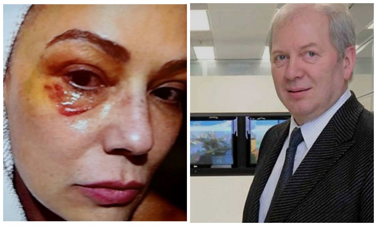 Desta vez, a agressão ocorreu nas redes sociais; o bilionário Lírio Parisotto disse já ter sido agredido por Luiza Brunet, tendo, segundo sua versão, levado dez pontos; Parisotto, que está proibido de se aproximar da ex-namorada, a chamou de "criatura hipócrita" (Foto: Leonardo Attuch) Desta vez, a agressão ocorreu nas redes sociais; o bilionário Lírio Parisotto disse já ter sido agredido por Luiza Brunet, tendo, segundo sua versão, levado dez pontos; Parisotto, que está proibido de se aproximar da ex-namorada, a chamou de "criatura hipócrita"