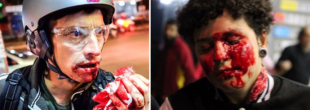 A ONG Conectas levou ao Conselho de Direitos Humanos das Nações Unidas em Genebra, nesta segunda-feira 19, um pedido para que o órgão internacional cobre explicações das autoridades brasileiras sobre a violência que tem sido praticada pela PM de São Paulo em manifestações pacíficas contra o governo; texto lembra que essa truculência já fez várias vítimas, como a estudante Deborah Fabri, que perdeu a visão de um olho após ter sido atingido com estilhaço de bomba (Foto: Gisele Federicce) A ONG Conectas levou ao Conselho de Direitos Humanos das Nações Unidas em Genebra, nesta segunda-feira 19, um pedido para que o órgão internacional cobre explicações das autoridades brasileiras sobre a violência que tem sido praticada pela PM de São Paulo em manifestações pacíficas contra o governo; texto lembra que essa truculência já fez várias vítimas, como a estudante Deborah Fabri, que perdeu a visão de um olho após ter sido atingido com estilhaço de bomba