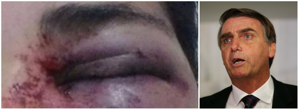 Uma jovem do Levante Popular da Juventude, do Distrito Federal, foi agredida a socos por um "admirador do Bolsonaro" em Samambaia; movimentos sociais, como o Movimento de Mulheres Camponesas (MMC), o MST e o Movimento dos Atingidos por Barragens (MAB) divulgaram nota de repúdio à agressão; "Precisamos contar essa história por acreditarmos e querermos outra sociedade", disse; a agressão foi classificada como "um ataque fascista, carregado de lesbofobia e misoginia" (Foto: Leonardo Lucena) Uma jovem do Levante Popular da Juventude, do Distrito Federal, foi agredida a socos por um "admirador do Bolsonaro" em Samambaia; movimentos sociais, como o Movimento de Mulheres Camponesas (MMC), o MST e o Movimento dos Atingidos por Barragens (MAB) divulgaram nota de repúdio à agressão; "Precisamos contar essa história por acreditarmos e querermos outra sociedade", disse; a agressão foi classificada como "um ataque fascista, carregado de lesbofobia e misoginia"