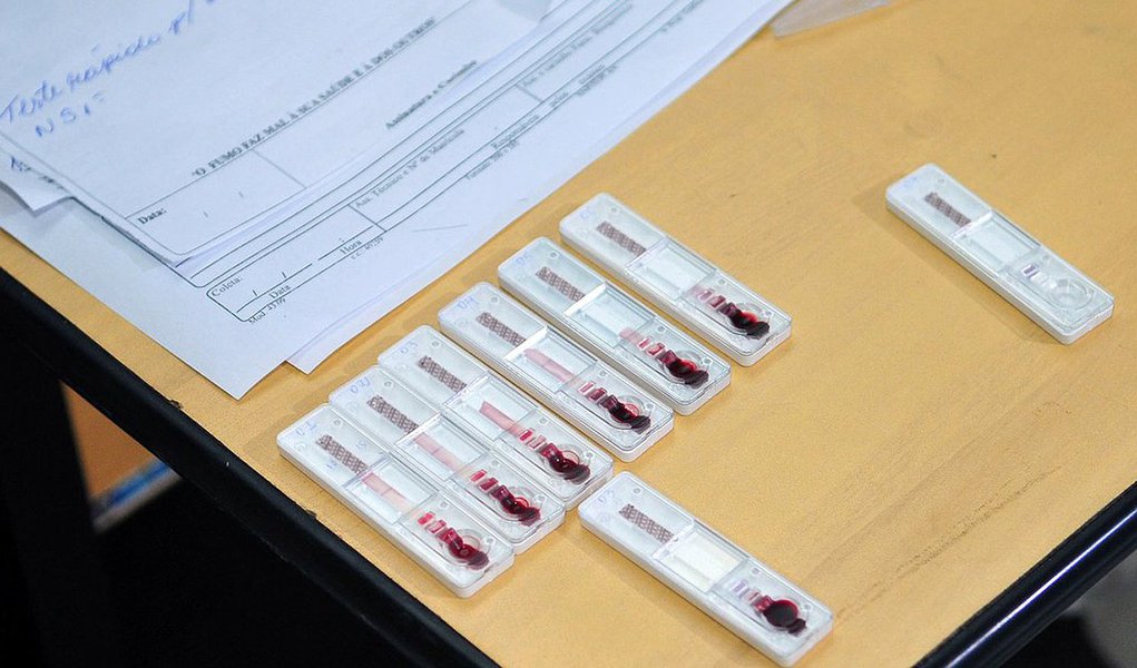O auge dos casos da dengue ocorre normalmente em abril e em maio, fim do período de chuvas no Distrito Federal; em ambos os meses, 2015 apresentou redução das ocorrências da doença em relação aos anos antecedentes. Neste ano, o resultado é ainda melhor; o mês passado foi o com menor número de contaminações desde 2012; de acordo com a Secretaria de Saúde, apresentaram quedas, com 3.953 pessoas em março, 3.349 em abril e chegando a 1.266 em maio; em 2015, o comportamento da doença foi o contrário: em fevereiro tinha 642 casos; março, 1.057; abril, 2.934; e maio, 2.425 (Foto: Leonardo Lucena) O auge dos casos da dengue ocorre normalmente em abril e em maio, fim do período de chuvas no Distrito Federal; em ambos os meses, 2015 apresentou redução das ocorrências da doença em relação aos anos antecedentes. Neste ano, o resultado é ainda melhor; o mês passado foi o com menor número de contaminações desde 2012; de acordo com a Secretaria de Saúde, apresentaram quedas, com 3.953 pessoas em março, 3.349 em abril e chegando a 1.266 em maio; em 2015, o comportamento da doença foi o contrário: em fevereiro tinha 642 casos; março, 1.057; abril, 2.934; e maio, 2.425