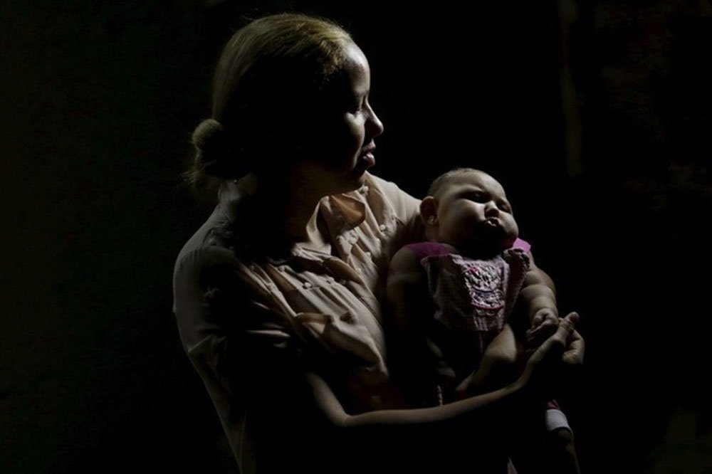 Mãe segurando filha com microcefalia em Recife. Casos de microcefalia em bebês foram relacionados ao Zika vírus no Brasil. REUTERS/Ueslei Marcelino (Foto: Romulo Faro) Mãe segurando filha com microcefalia em Recife. Casos de microcefalia em bebês foram relacionados ao Zika vírus no Brasil. REUTERS/Ueslei Marcelino