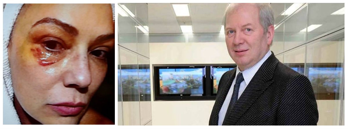 Imagem foi anexada ao processo em que a atriz acusa o ex-companheiro Lírio Parisotto, um dos homens mais ricos do Brasil, de agredi-la; “A maquiagem forte esconde o hematoma da alma” (Foto: Leonardo Attuch) Imagem foi anexada ao processo em que a atriz acusa o ex-companheiro Lírio Parisotto, um dos homens mais ricos do Brasil, de agredi-la; “A maquiagem forte esconde o hematoma da alma”