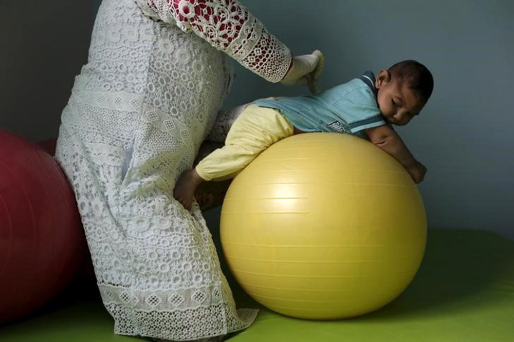Bebê com microcefalia durante fisioterapia em Campina Grande 17/2/2016 REUTERS/Ricardo Moraes (Foto: Romulo Faro) Bebê com microcefalia durante fisioterapia em Campina Grande 17/2/2016 REUTERS/Ricardo Moraes