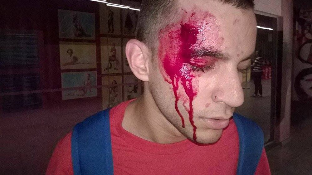 Kaique Dalapola cresceu no Grajaú, periferia da zona sul de São Paulo, e só estudou em escola pública; neste mês, o estudante de jornalismo levou cinco pontos depois de tomar uma cacetada da polícia enquanto cobria protesto de alunos contra a reforma escolar de Alckmin; no dia seguinte, foi demitido e soube que o curso de sua faculdade seria fechado (Foto: Gisele Federicce) Kaique Dalapola cresceu no Grajaú, periferia da zona sul de São Paulo, e só estudou em escola pública; neste mês, o estudante de jornalismo levou cinco pontos depois de tomar uma cacetada da polícia enquanto cobria protesto de alunos contra a reforma escolar de Alckmin; no dia seguinte, foi demitido e soube que o curso de sua faculdade seria fechado