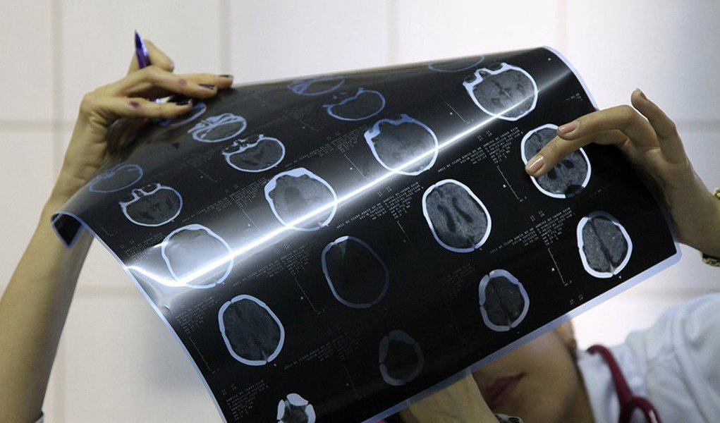 O Ministério da Saúde confirmou dois casos de microcefalia associados ao zika vírus em Brasília; outros 10 estão em investigação; de outubro até esta quarta (15), período contabilizado pelo Boletim Epidemiológico ministerial, foram registradas 37 suspeitas no DF e 25 casos foram descartados; a pasta e os estados investigam 4.268 casos suspeitos de microcefalia em todo o País, o que representa 65,9% dos casos notificados; o novo informe aponta que 2.212 casos foram investigados e classificados, sendo 1.349 descartados e 863 confirmados para microcefalia e outras alterações do sistema nervoso, sugestivos de infecção congênita (Foto: Leonardo Lucena) O Ministério da Saúde confirmou dois casos de microcefalia associados ao zika vírus em Brasília; outros 10 estão em investigação; de outubro até esta quarta (15), período contabilizado pelo Boletim Epidemiológico ministerial, foram registradas 37 suspeitas no DF e 25 casos foram descartados; a pasta e os estados investigam 4.268 casos suspeitos de microcefalia em todo o País, o que representa 65,9% dos casos notificados; o novo informe aponta que 2.212 casos foram investigados e classificados, sendo 1.349 descartados e 863 confirmados para microcefalia e outras alterações do sistema nervoso, sugestivos de infecção congênita