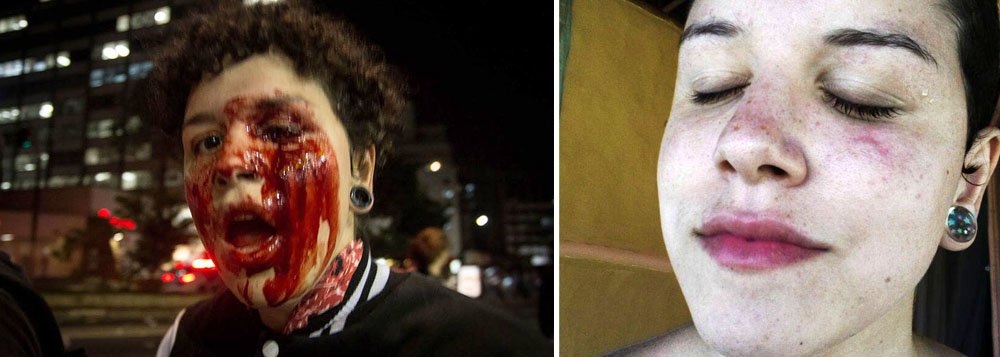 A estudante Deborah Fabri, que perdeu um olho durante repressão da Polícia Militar de São Paulo a protesto em agosto contra o impeachment da presidente Dilma Rousseff, fez um relato contundente sobre o caso; ela diz que não se arrepende de ter se manifestado contra o golpe parlamentar; "'Valeu a pena?' Não faz sentido perguntar isso a mim, é melhor perguntar para a PM se valeu a pena ter utilizado seus instrumentos de dominação das classes reacionárias e dos monopólios imperialistas para lesionar permanentemente alguém que estava em exercício de seu direito, não cometendo crime algum", afirma Deborah (Foto: Aquiles Lins) A estudante Deborah Fabri, que perdeu um olho durante repressão da Polícia Militar de São Paulo a protesto em agosto contra o impeachment da presidente Dilma Rousseff, fez um relato contundente sobre o caso; ela diz que não se arrepende de ter se manifestado contra o golpe parlamentar; "'Valeu a pena?' Não faz sentido perguntar isso a mim, é melhor perguntar para a PM se valeu a pena ter utilizado seus instrumentos de dominação das classes reacionárias e dos monopólios imperialistas para lesionar permanentemente alguém que estava em exercício de seu direito, não cometendo crime algum", afirma Deborah