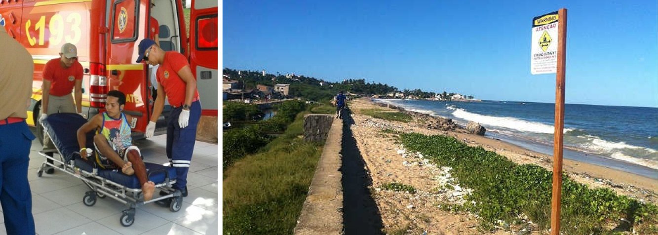 Diego Gomes Mota (23) foi atacado nesta terça-feira 31 enquanto surfava com amigos na praia Del Chifre, em Olinda; ferido na perna, ele foi socorrido e o seu estado de saúde é considerado estável; este é o 60º caso de ataque em Pernambuco desde 1992, quando as ocorrências do gênero passaram a ser acompanhadas (Foto: Paulo Emílio) Diego Gomes Mota (23) foi atacado nesta terça-feira 31 enquanto surfava com amigos na praia Del Chifre, em Olinda; ferido na perna, ele foi socorrido e o seu estado de saúde é considerado estável; este é o 60º caso de ataque em Pernambuco desde 1992, quando as ocorrências do gênero passaram a ser acompanhadas
