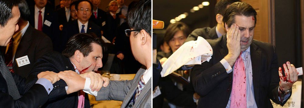 A Coreia do Norte declarou hoje (5) que a agressão do embaixador norte-americano, Mark Lipper, em Seul era "um castigo justo" pela decisão dos Estados Unidos de fazer exercícios militares conjuntos com a Coreia do Sul; "Castigo justo para os belicistas dos Estados Unidos", disse a agência oficial da Coreia do Norte, KCNA, no título de um breve texto, no qual o ataque contra Lippert é chamado de "expressão de resistência" (Foto: Paulo Emílio) A Coreia do Norte declarou hoje (5) que a agressão do embaixador norte-americano, Mark Lipper, em Seul era "um castigo justo" pela decisão dos Estados Unidos de fazer exercícios militares conjuntos com a Coreia do Sul; "Castigo justo para os belicistas dos Estados Unidos", disse a agência oficial da Coreia do Norte, KCNA, no título de um breve texto, no qual o ataque contra Lippert é chamado de "expressão de resistência"