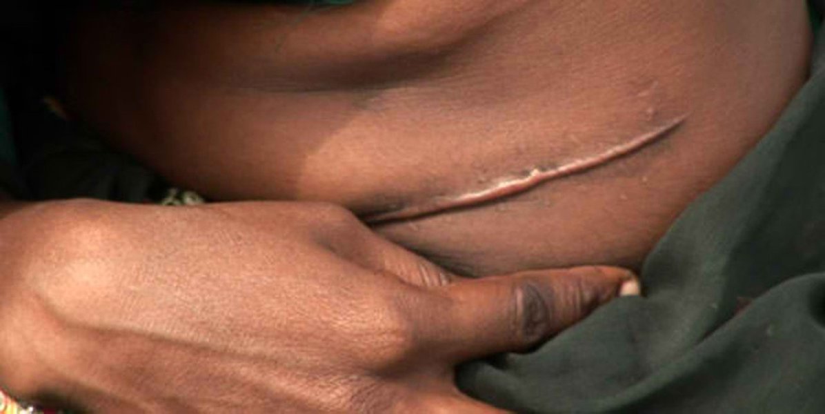 Nem todos os órgãos do corpo humano são indispensáveis. Alguns podem ser doados ou... vendidos. Quanto vale um rim no mercadonegro? Além de ilegal em quase todos os países do mundo, privar-se de um órgão é muito perigoso. Comprá-lo, também (Foto: Gisele Federicce) Nem todos os órgãos do corpo humano são indispensáveis. Alguns podem ser doados ou... vendidos. Quanto vale um rim no mercadonegro? Além de ilegal em quase todos os países do mundo, privar-se de um órgão é muito perigoso. Comprá-lo, também