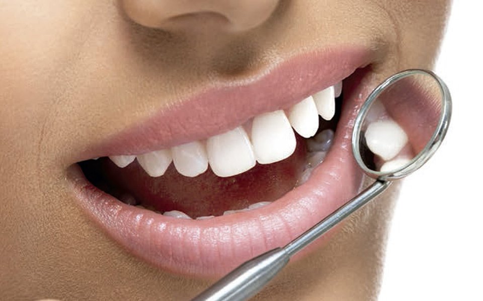 Infecções da boca. Como se proteger das gengivites, aftas, cáries e abcessos Infecções da boca. Como se proteger das gengivites, aftas, cáries e abcessos