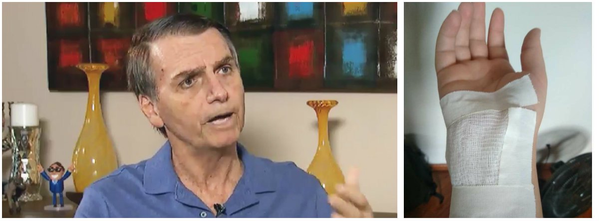 Mulher agredida diz que todo bolsonarista tem a mão suja de sangue Mulher agredida diz que todo bolsonarista tem a mão suja de sangue