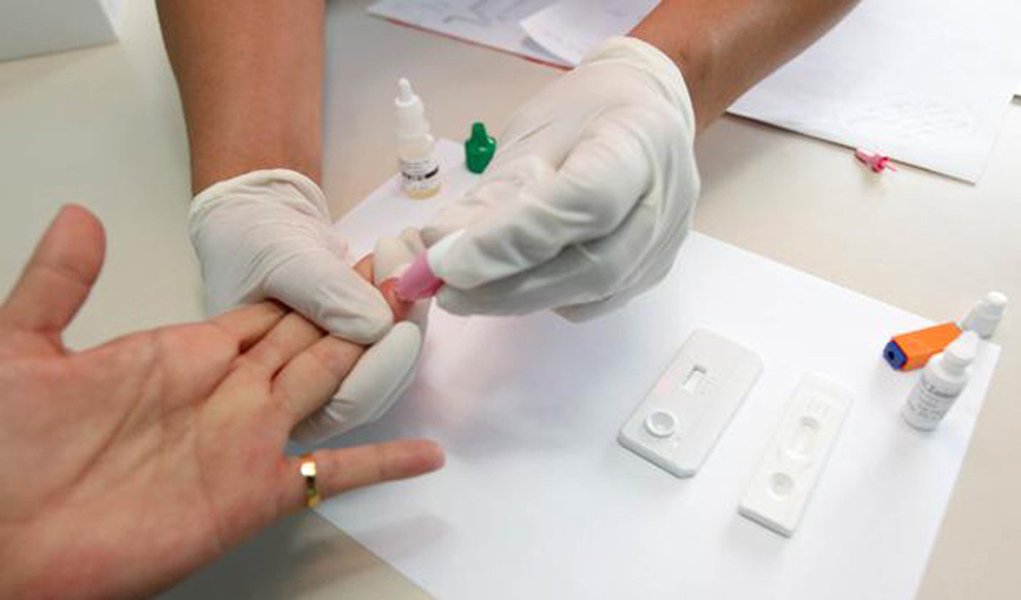 Governo oferece mil testes rápidos de HIV na semana da Parada LGBT (Foto: Divulgação) Governo oferece mil testes rápidos de HIV na semana da Parada LGBT