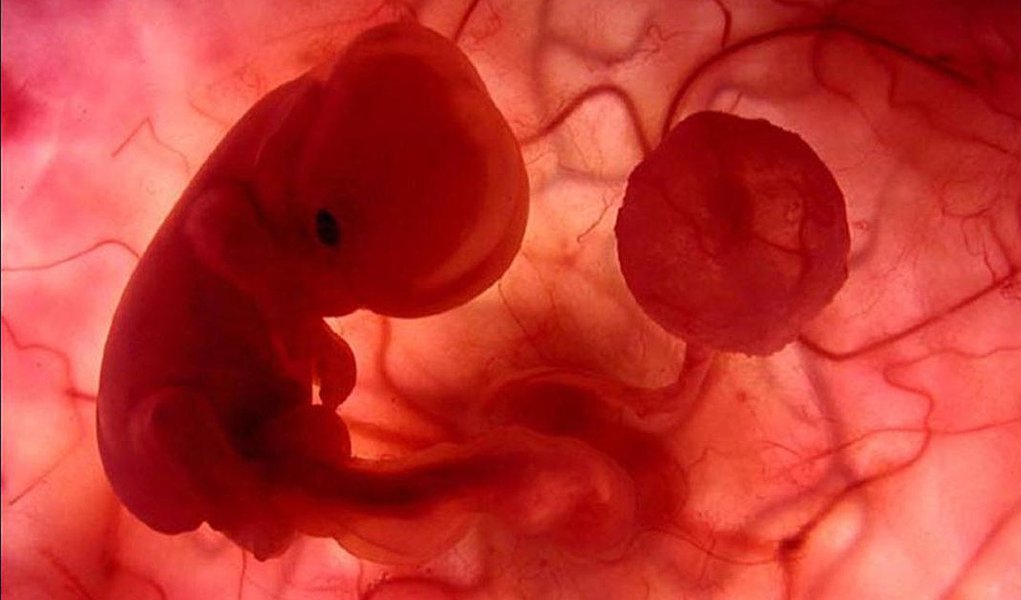 Governo nega mudanças na lei do aborto Governo nega mudanças na lei do aborto