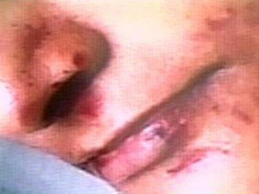 Grávida morta em presídio tinha hematomas no rosto (Foto: Reprodução/TV Anhanguera) Grávida morta em presídio tinha hematomas no rosto
