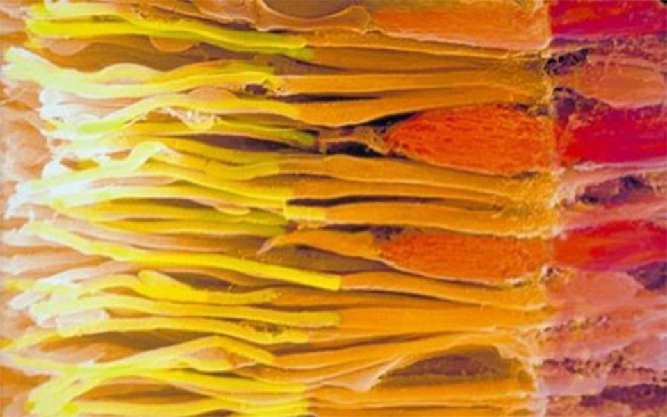 Retina artificial. No futuro, irá restaurar a vista dos cegos Retina artificial. No futuro, irá restaurar a vista dos cegos