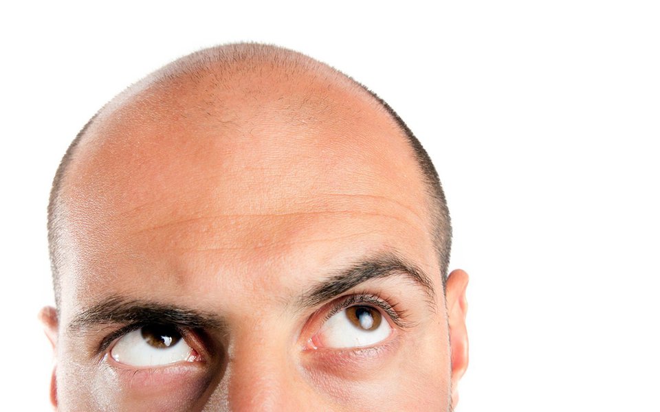 O algoritmo da calvície. Genes ajudam a prever a perda de cabelo em homens (Foto: © mehmetdinler|2013) O algoritmo da calvície. Genes ajudam a prever a perda de cabelo em homens