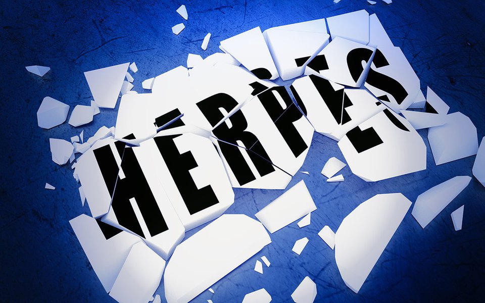 Herpes, uma pandemia mundial. Número de casos aumenta a cada dia Herpes, uma pandemia mundial. Número de casos aumenta a cada dia