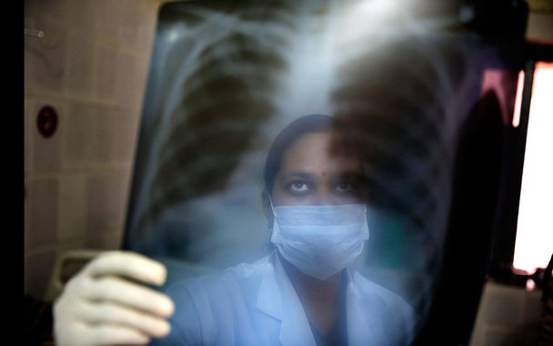 Tuberculose. Rio registra cerca de 12 mil novos casos a cada ano (Foto: Rajesh Kumar Singh) Tuberculose. Rio registra cerca de 12 mil novos casos a cada ano