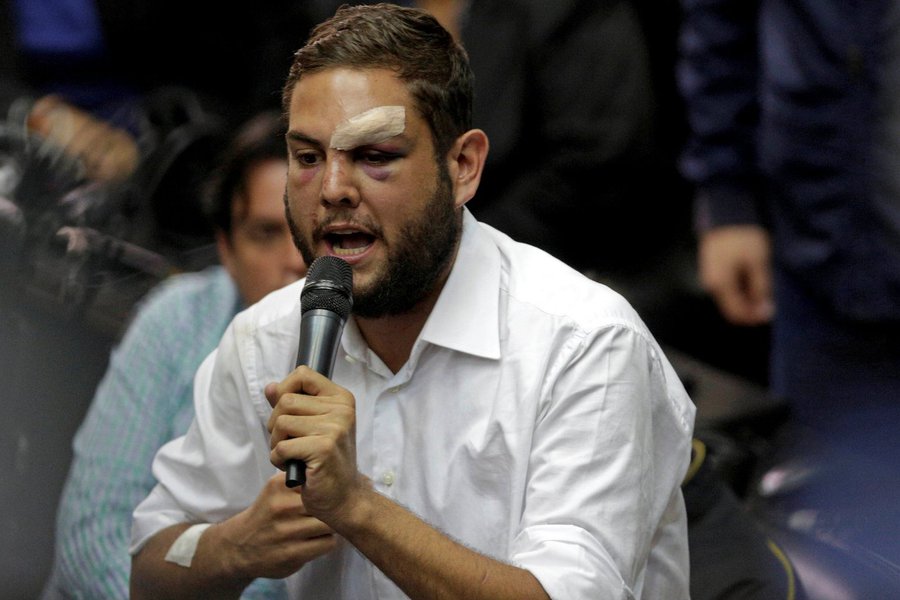 Venezuela determina prisão de políticos oposicionistas após explosão de drones (Foto: Marco Bello) Venezuela determina prisão de políticos oposicionistas após explosão de drones