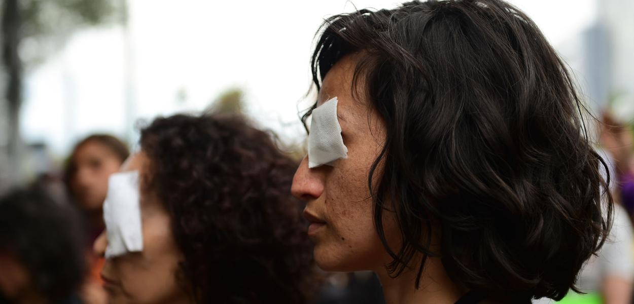Mais de 200 pessoas ficam cegas no Chile com repressão aos protestos (Foto: Martin Bernetti/AFP) Mais de 200 pessoas ficam cegas no Chile com repressão aos protestos