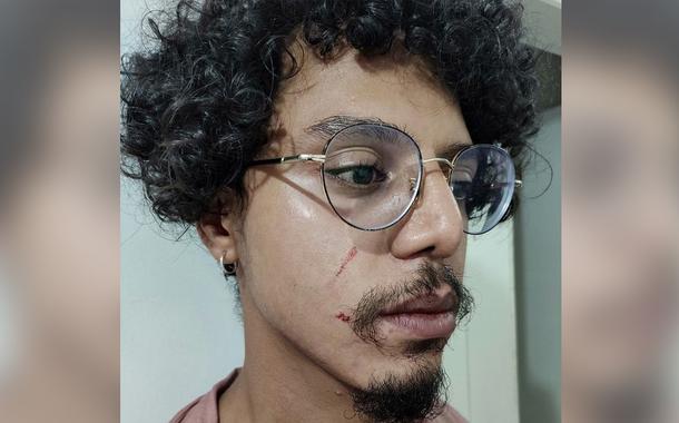 Renan Rodrigues (Foto: Reprodução) Renan Rodrigues