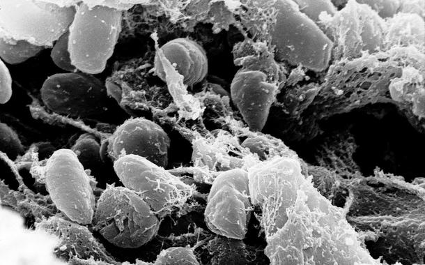 Credit:ʠRocky Mountain Laboratories, NIAID, NIH
Scanning electron micrograph depicting a mass of Yersinia pestis bacteria (the cause of bubonic plague) in the foregut of the flea vector
(Foto: Reprodução) Credit:ʠRocky Mountain Laboratories, NIAID, NIH
Scanning electron micrograph depicting a mass of Yersinia pestis bacteria (the cause of bubonic plague) in the foregut of the flea vector