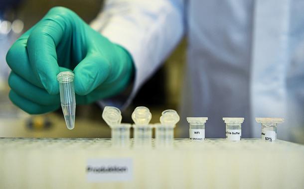 Instituto Senai de Inovação em Química Verde (ISI QV) e Scienco Biotecnologia, de Santa Catarina, formam parceria para inovação em testes da Covid-19 (Foto: REUTERS/Andreas Gebert) Instituto Senai de Inovação em Química Verde (ISI QV) e Scienco Biotecnologia, de Santa Catarina, formam parceria para inovação em testes da Covid-19