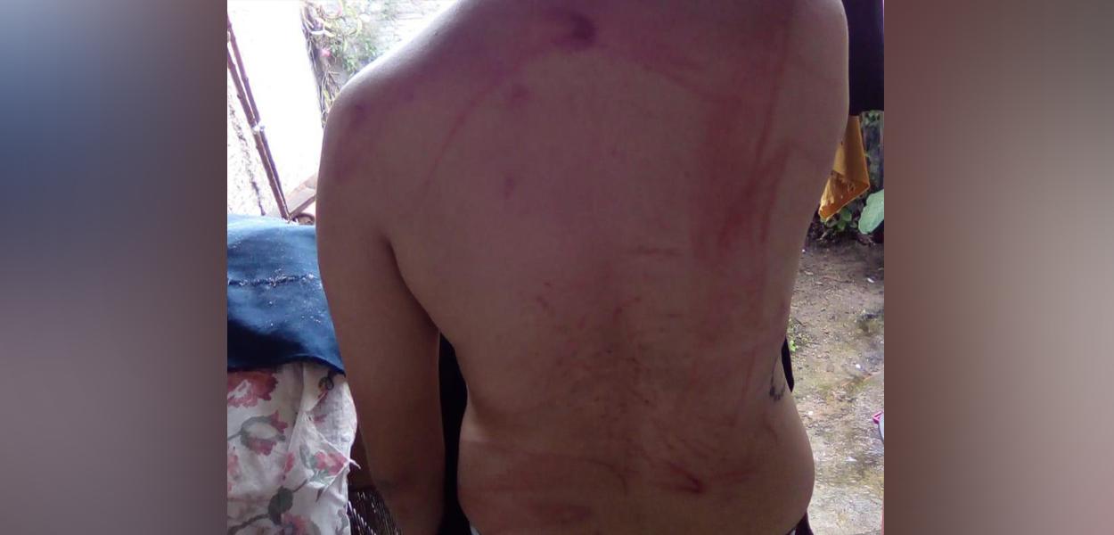 Adolescente de 16 anos foi espancada pelo pai por ser lésbica, na Bahia (Foto: Divulgação/Polícia Civil) Adolescente de 16 anos foi espancada pelo pai por ser lésbica, na Bahia
