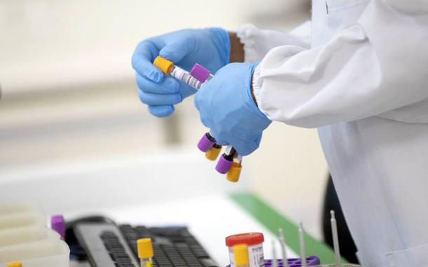 Testes de Covid estão em falta em todo o País. Associação de laboratórios sugere parar testagem de assintomáticos