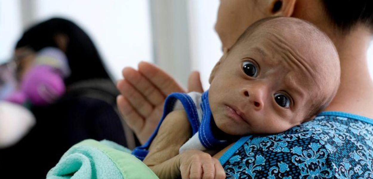 Mãe aguarda com seu filho de 2 meses, diagnosticado com desnutrição, por exame em clínica venezuelana (Foto: REUTERS/Carlos Garcia Rawlins) Mãe aguarda com seu filho de 2 meses, diagnosticado com desnutrição, por exame em clínica venezuelana