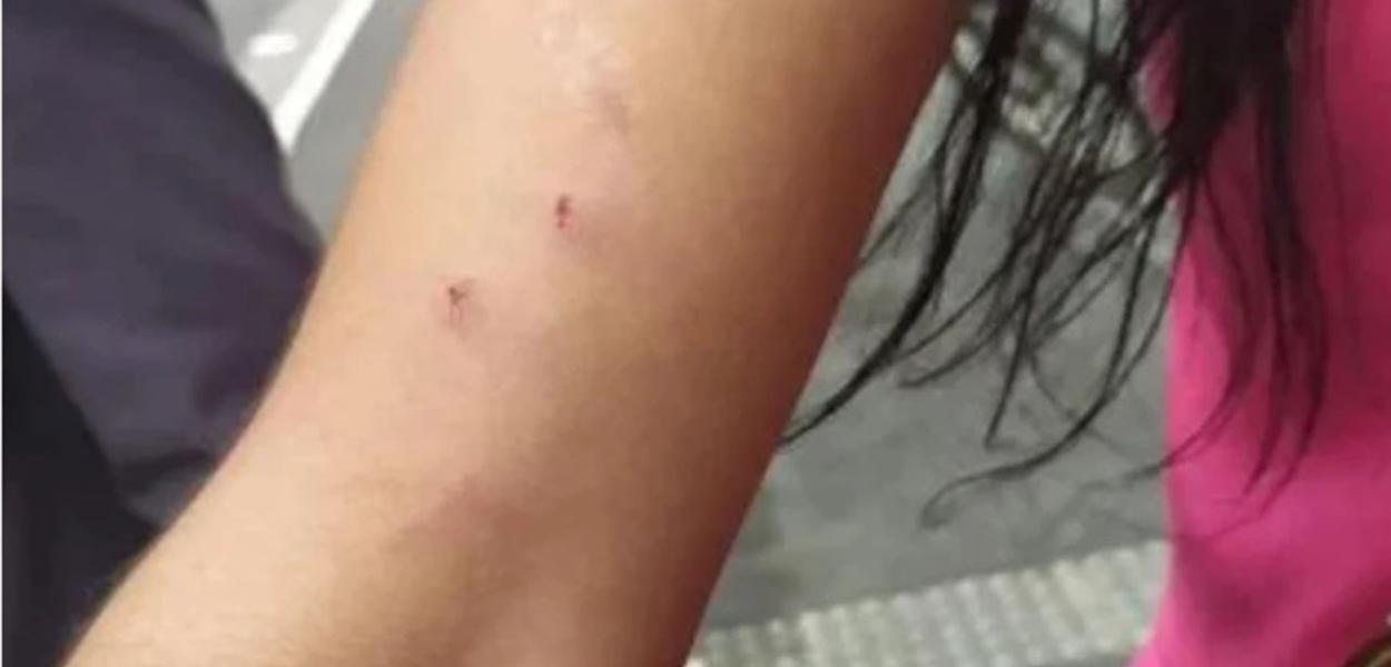 Patrícia Borges foi violentada durante ato de campanha em São Paulo (Foto: Reprodução (Twitter)) Patrícia Borges foi violentada durante ato de campanha em São Paulo