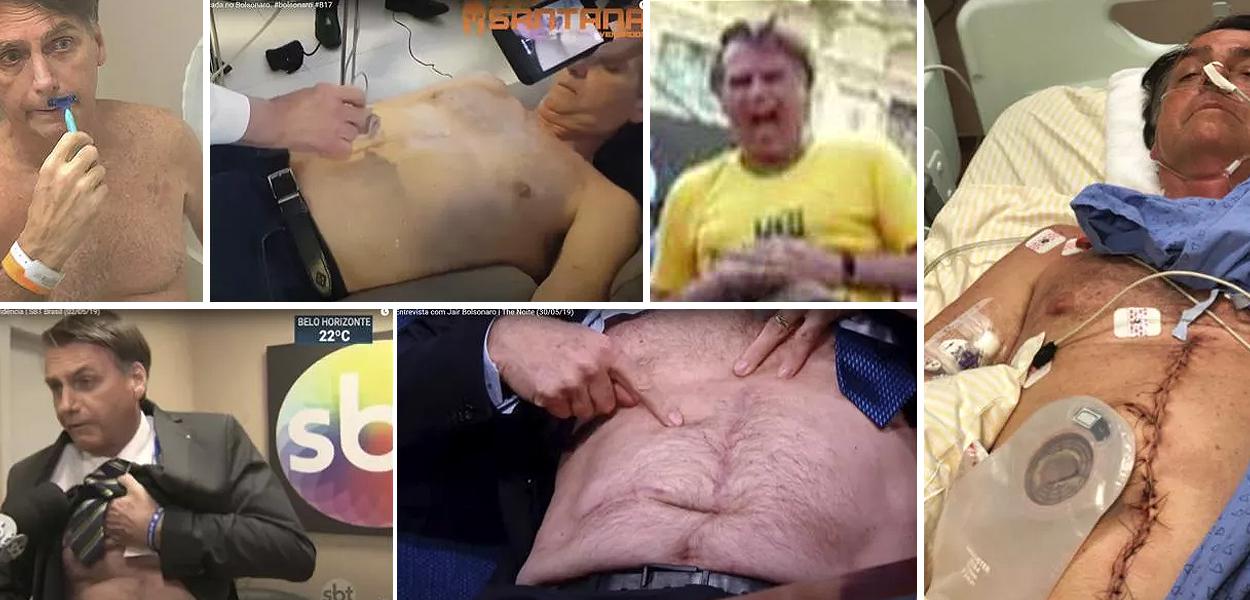O exame revela que, estranhamento, a cicatriz mudou de lugar (Foto: Reprodução) O exame revela que, estranhamento, a cicatriz mudou de lugar
