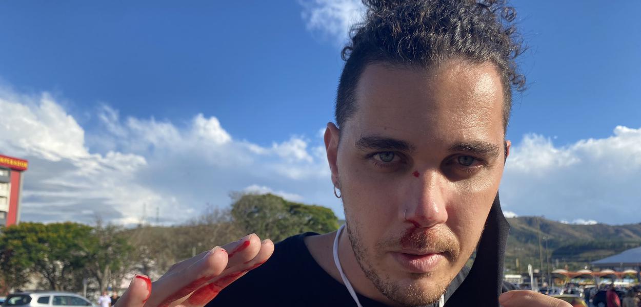 Leandro Matozo, cinegrafista da Globonews agredido em Aparecida (Foto: Twitter/Victor Ferreira) Leandro Matozo, cinegrafista da Globonews agredido em Aparecida