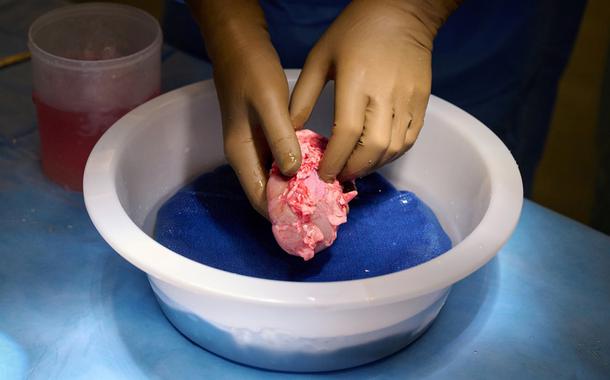 (Foto: Joe Carrotta para NYU Langone Health/via Reuters)