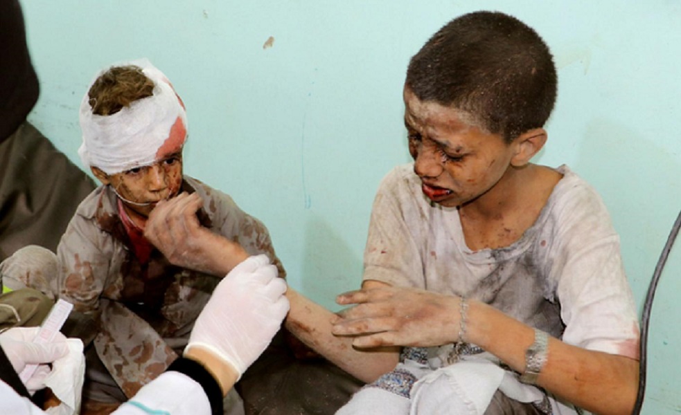 Médico trata crianças feridas depois de bombardeio saudita à cidade iemenita de Sa'ada (Foto: Reuters) www.brasil247.com - Médico trata crianças feridas depois de bombardeio saudita à cidade iemenita de Sa'ada