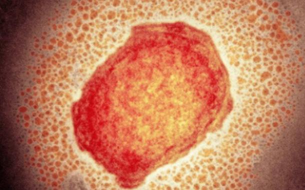 (Foto: Science Photo Library)