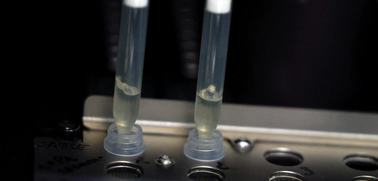 Duas amostras de casos suspeitos de varíola dos macacos são testadas em laboratório de microbiologia. (Foto: REUTERS/Susana Vera) www.brasil247.com - Duas amostras de casos suspeitos de varíola dos macacos são testadas em laboratório de microbiologia.