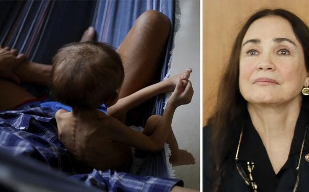 Indígenas ianomâmi em quadro de desnutrição em Boa Vista, Roraima e Regina Duarte (Foto: REUTERS/Amanda Perobelli | Isac Nóbrega/PR) Indígenas ianomâmi em quadro de desnutrição em Boa Vista, Roraima e Regina Duarte